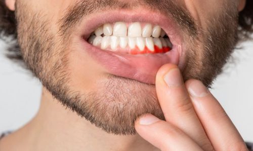 პაროდონტოლოგია