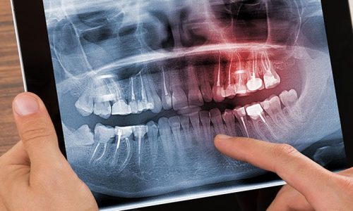 ქირურგიული სტომატოლოგია